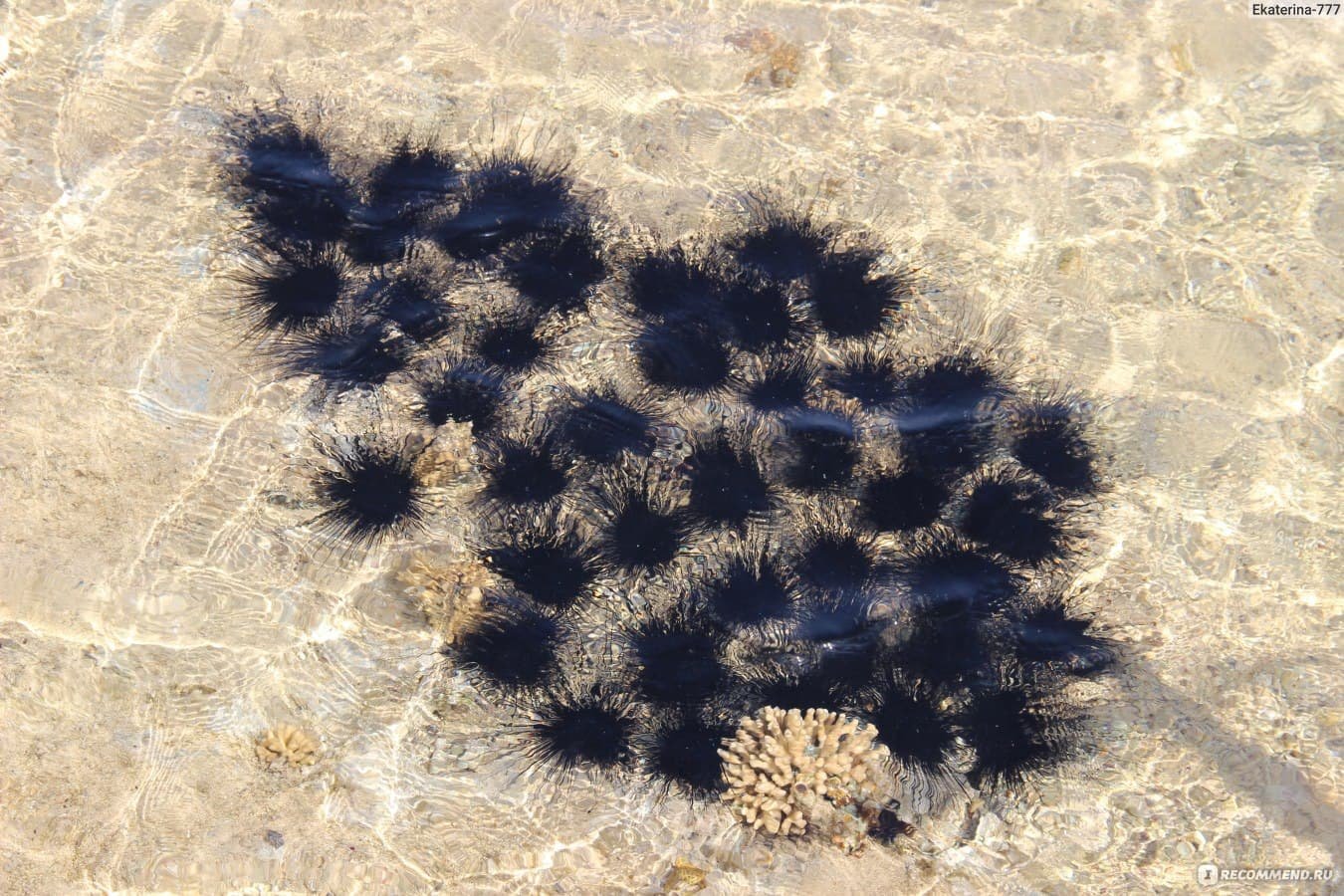 Symptoms of a Sea Urchin Sting Symptoms of a Sea Urchin Sting